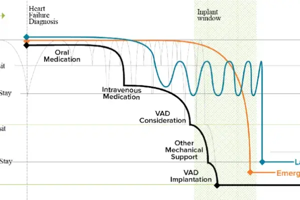 VAD Transplant Chart